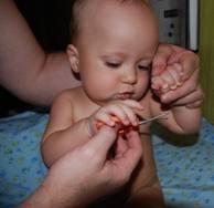 podstr detam nogotki